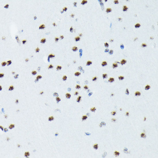 Phospho-p70 S6 Kinase 1-T421/S424 Rabbit mAb