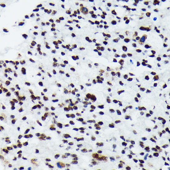 Phospho-p70 S6 Kinase 1-T421/S424 Rabbit mAb