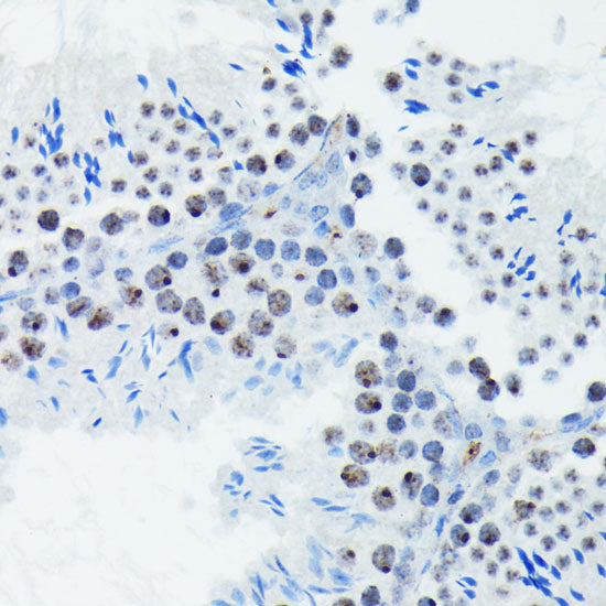 Phospho-p70 S6 Kinase 1-T421/S424 Rabbit mAb