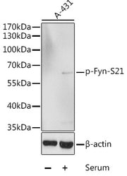 Phospho-Fyn-S21 Rabbit pAb