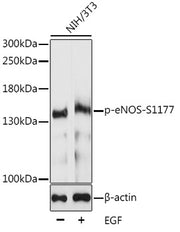 Phospho-eNOS-S1177 Rabbit pAb