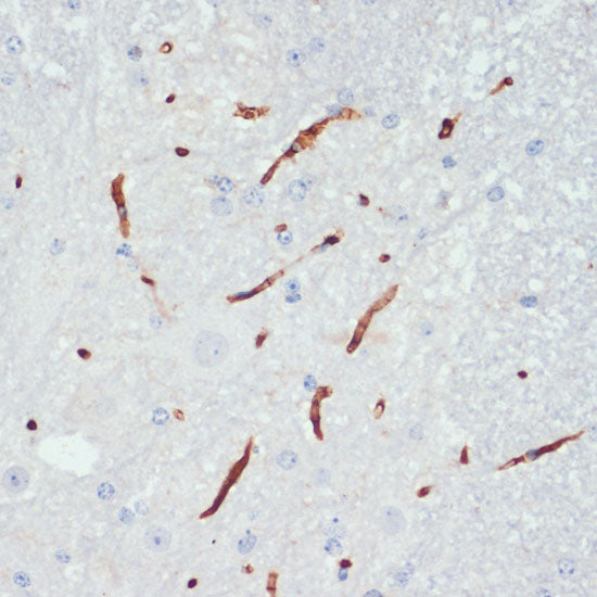Phospho-eNOS-S1177 Rabbit pAb