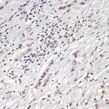 Phospho-JAK2-Y1007/1008 Rabbit pAb