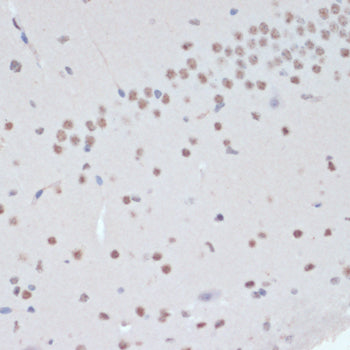 Phospho-JAK2-Y1007/1008 Rabbit pAb