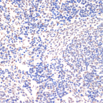 Phospho-JAK2-Y1007/1008 Rabbit pAb