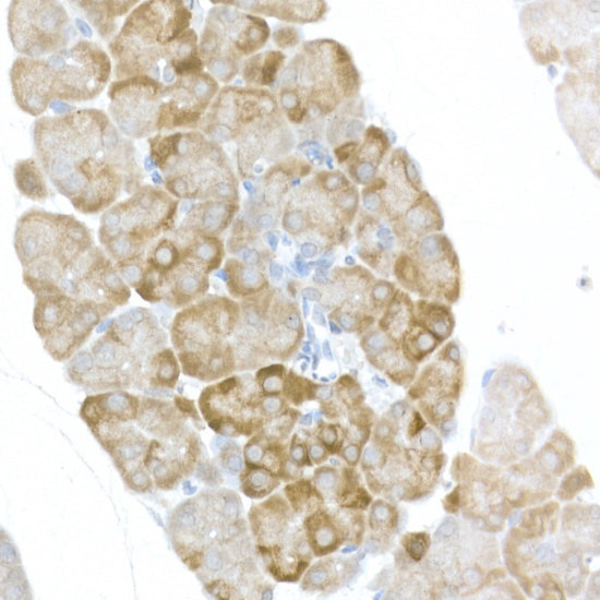 Phospho-S6 Ribosomal Protein (RPS6)-S240/244 Rabbit pAb