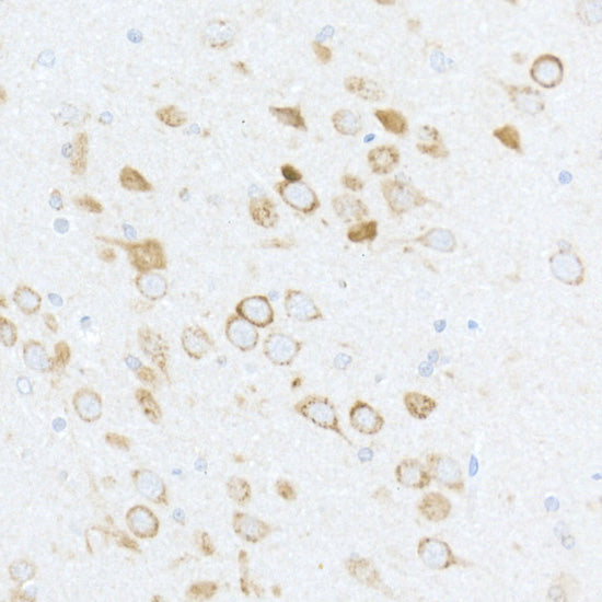 Phospho-S6 Ribosomal Protein (RPS6)-S240/244 Rabbit pAb