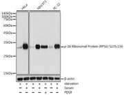 Phospho-S6 Ribosomal Protein (RPS6)-S235/236 Rabbit pAb