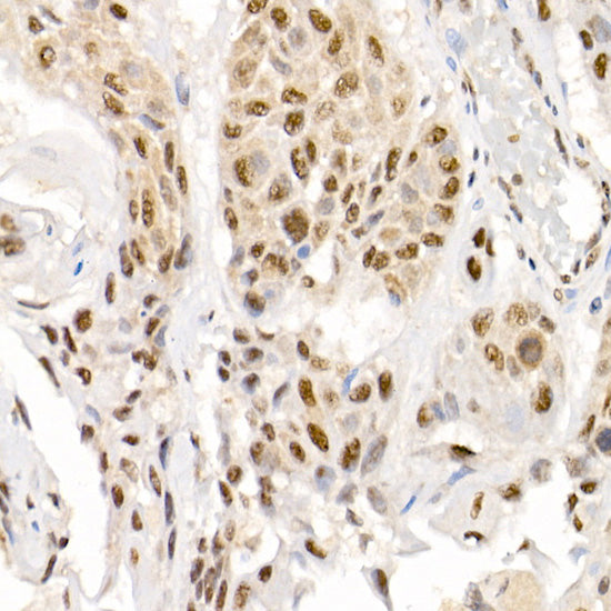 Phospho-Smad2-S465/467 + Smad3-S423/425 Rabbit pAb