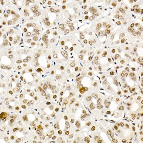 Phospho-Smad2-S465/467 + Smad3-S423/425 Rabbit pAb