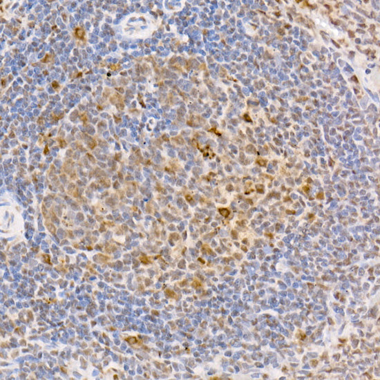 Phospho-Smad2-S465/467 + Smad3-S423/425 Rabbit pAb