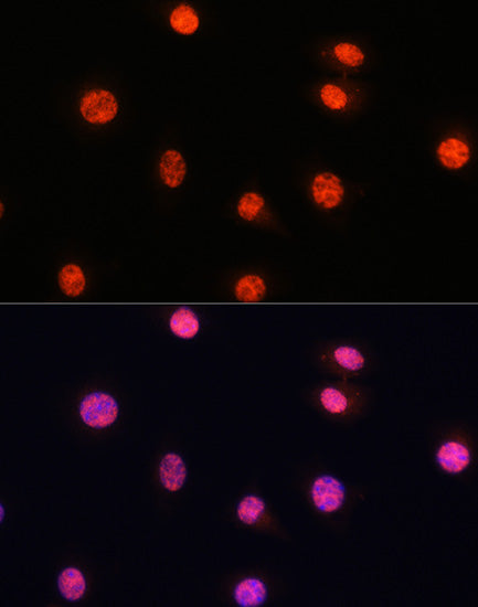 Phospho-Smad2-S465/467 + Smad3-S423/425 Rabbit pAb