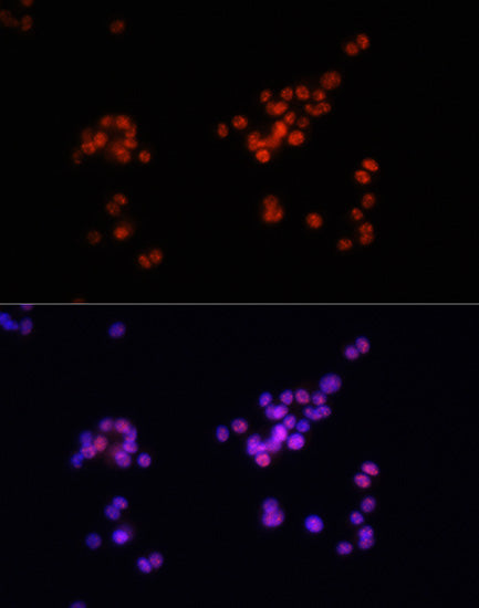 Phospho-Smad2-S465/467 + Smad3-S423/425 Rabbit pAb