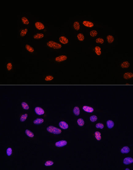 Phospho-Smad2-S465/467 + Smad3-S423/425 Rabbit pAb