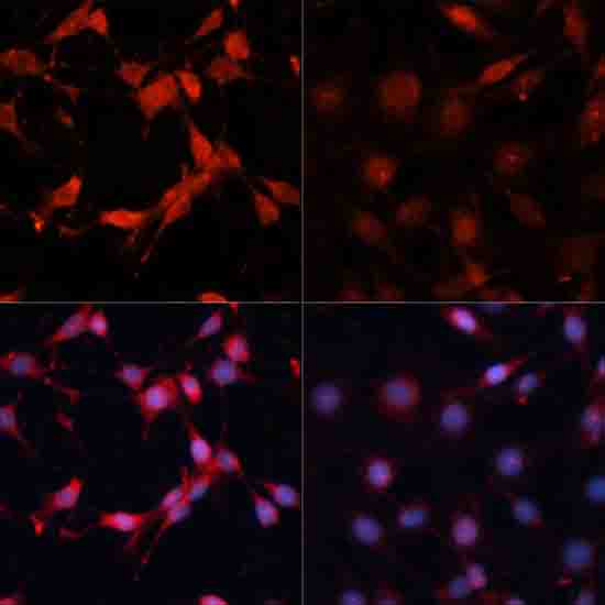 Phospho-p70 S6 Kinase 1-T389 Rabbit pAb