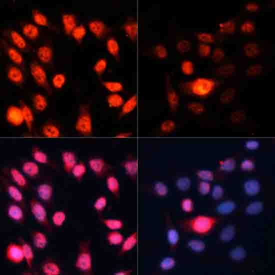 Phospho-p70 S6 Kinase 1-T389 Rabbit pAb