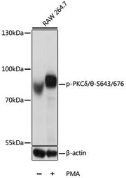 Phospho-PKCδ/θ-S643/676 Rabbit pAb
