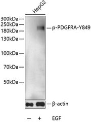 Phospho-PDGFR alpha-Y849 Rabbit pAb
