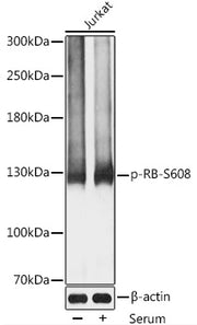 Phospho-RB-S608 Rabbit pAb