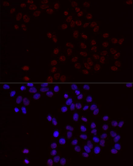 Phospho-Bcl-2-S70 Rabbit pAb