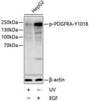 Phospho-PDGFR alpha-Y1018 Rabbit pAb