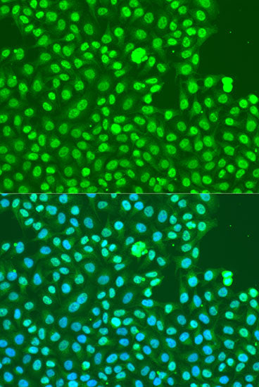 Phospho-DNA-PKcs-S2056 Rabbit pAb