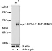 Phospho-JNK1/2/3-T183/T183/T221 Rabbit mAb