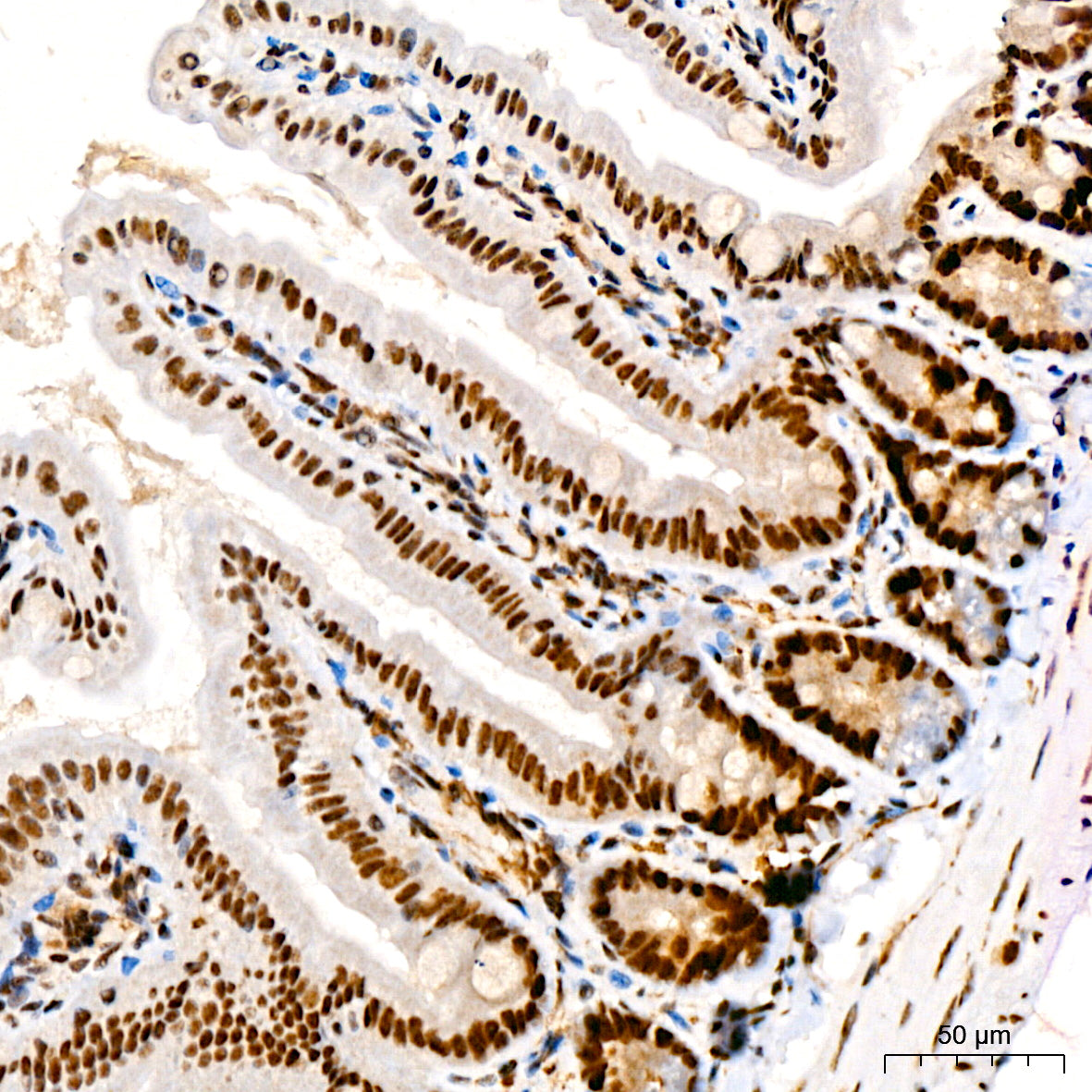 Phospho-JNK1/2/3-T183/T183/T221 Rabbit mAb