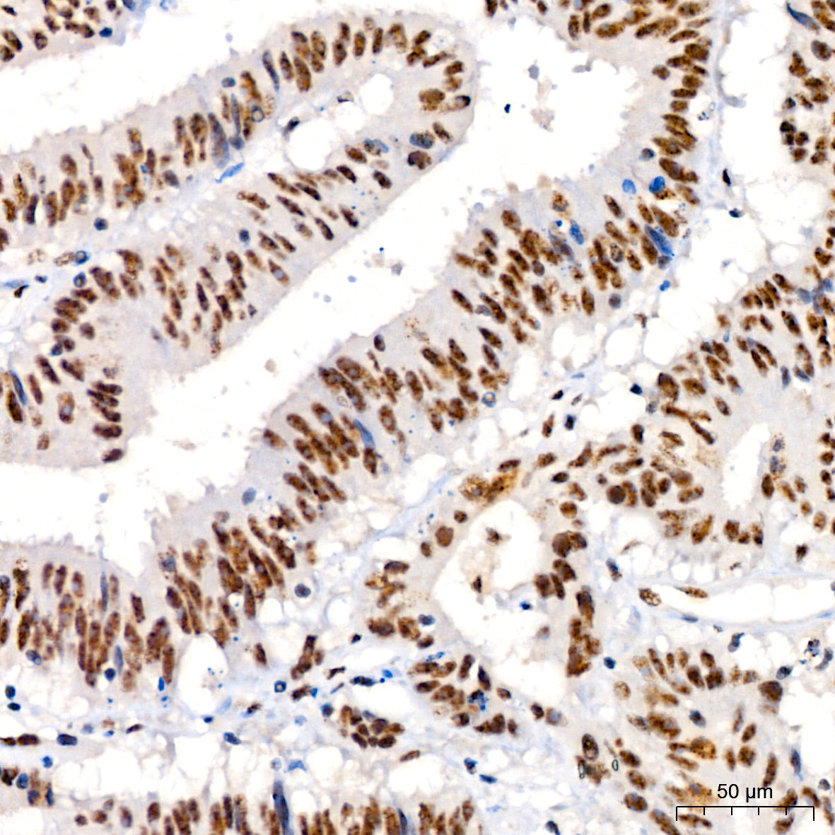 Phospho-JNK1/2/3-T183/T183/T221 Rabbit mAb