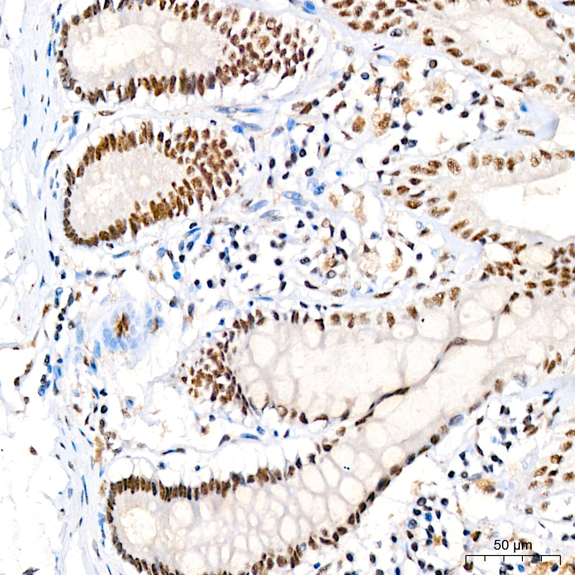 Phospho-JNK1/2/3-T183/T183/T221 Rabbit mAb