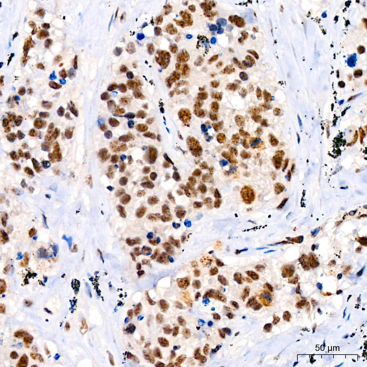 Phospho-JNK1/2/3-T183/T183/T221 Rabbit mAb