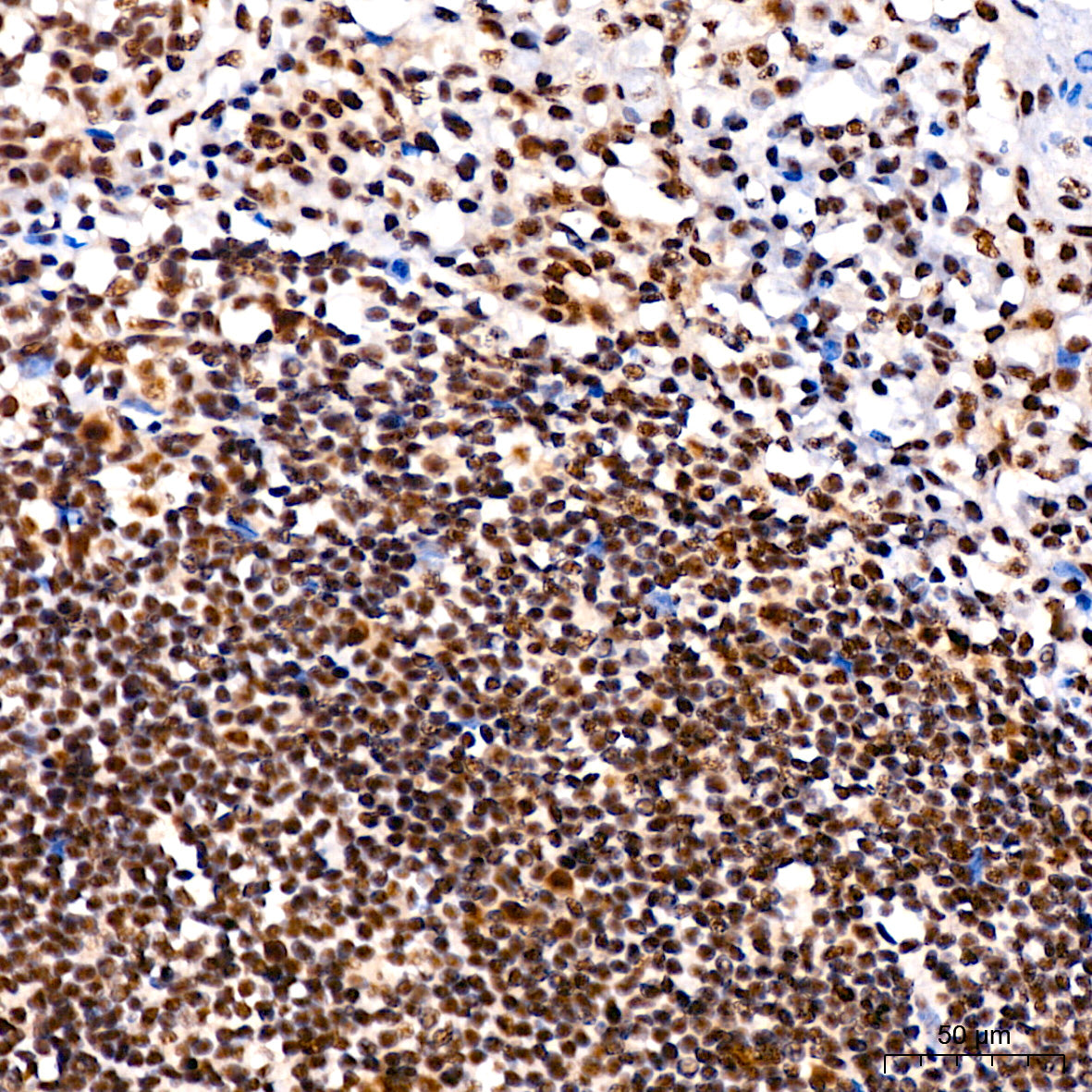 Phospho-JNK1/2/3-T183/T183/T221 Rabbit mAb