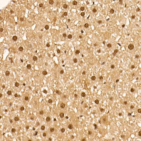 Phospho-AKT-S473 Rabbit mAb