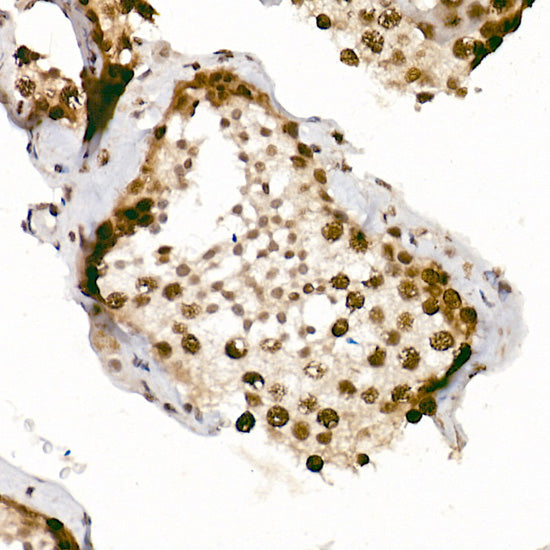 Phospho-ATR-S428 Rabbit pAb