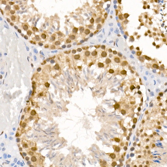 Phospho-ATR-S428 Rabbit pAb