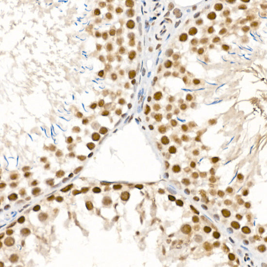 Phospho-ATR-S428 Rabbit pAb