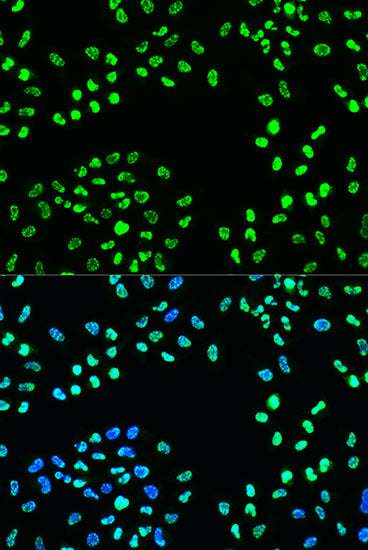 Phospho-ATR-S428 Rabbit pAb