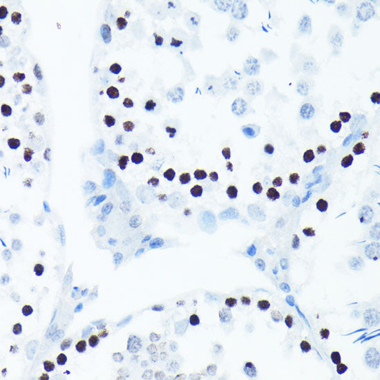 Phospho-Histone H2AX-S139 Rabbit mAb