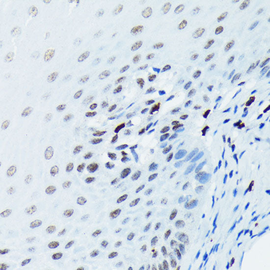 Phospho-Histone H2AX-S139 Rabbit mAb