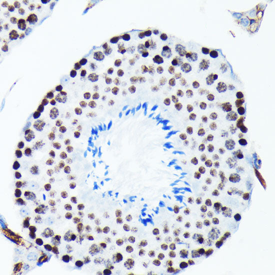 Phospho-Histone H2AX-S139 Rabbit mAb