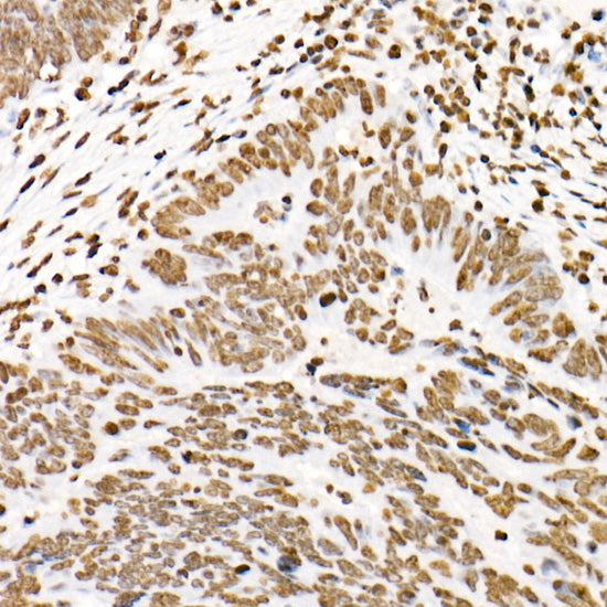 Phospho-STAT3-Y705 Rabbit mAb