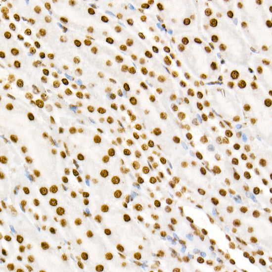 Phospho-STAT3-Y705 Rabbit mAb