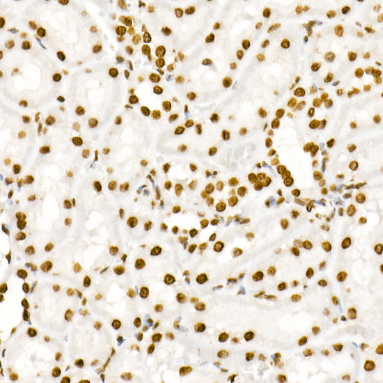 Phospho-STAT3-Y705 Rabbit mAb