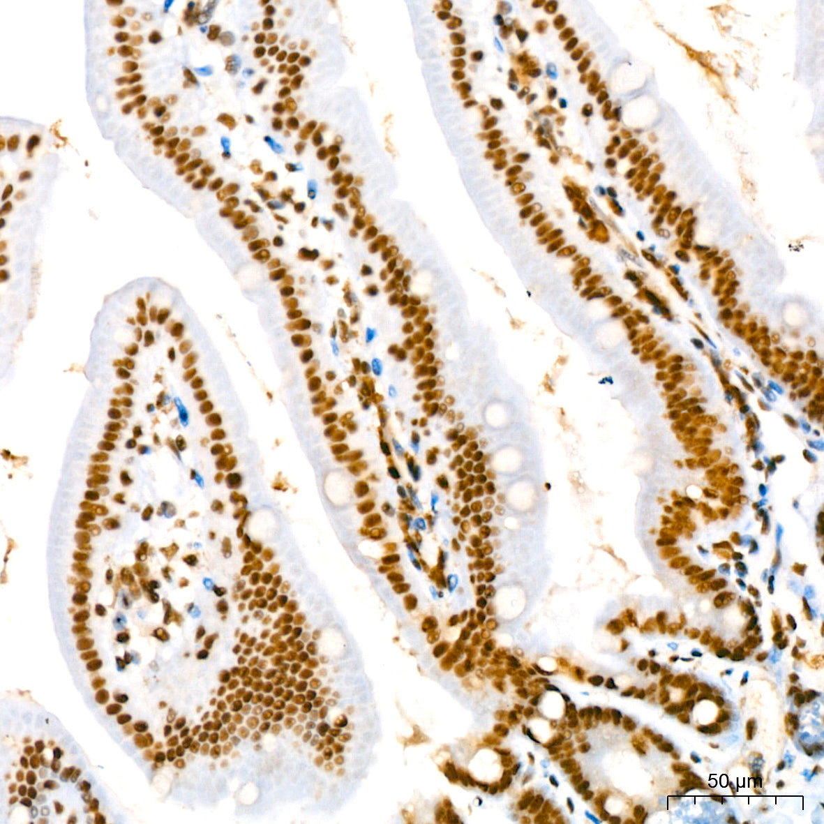 Phospho-STAT3-Y705 Rabbit mAb