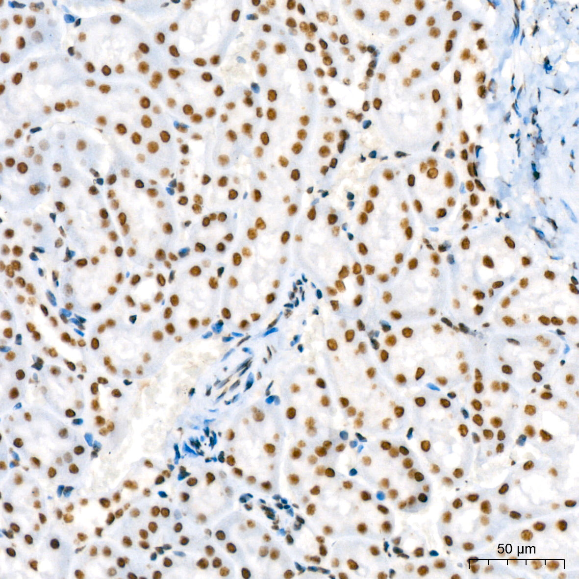 Phospho-STAT3-Y705 Rabbit mAb
