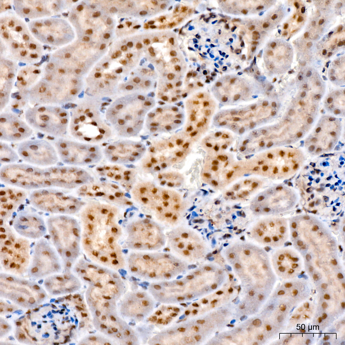 Phospho-STAT3-S727 Rabbit mAb
