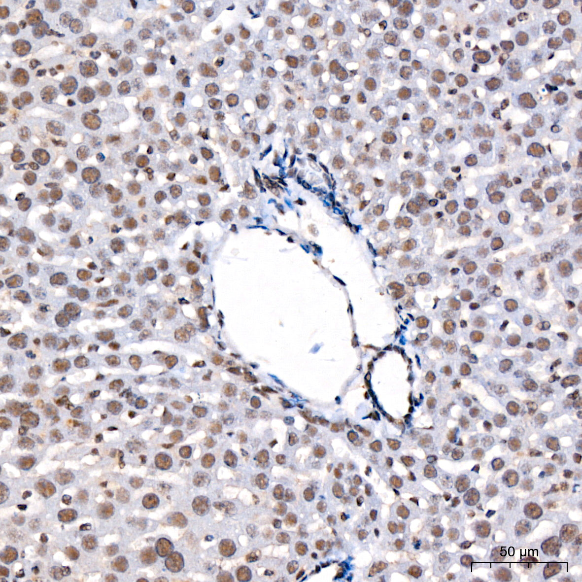 Phospho-STAT3-S727 Rabbit mAb