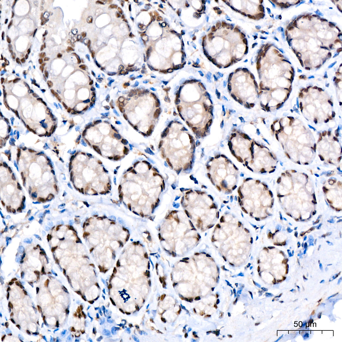 Phospho-STAT3-S727 Rabbit mAb
