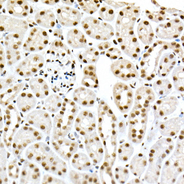 Phospho-Smad3-S423/S425 Rabbit mAb