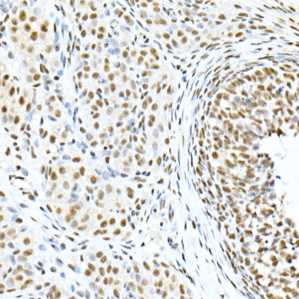 Phospho-Smad3-S423/S425 Rabbit mAb
